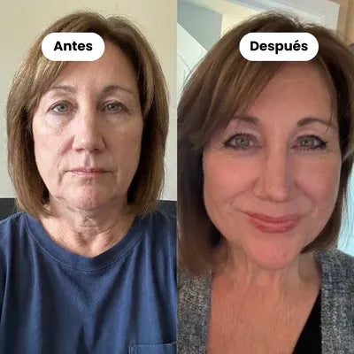 Faja Facial FirmFace — Colores rosa y gris
