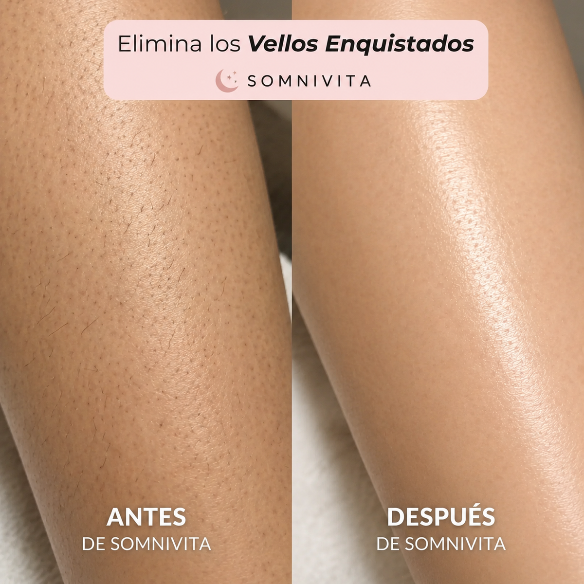 Somnivita® Antifaz Ergonómico Total Dark