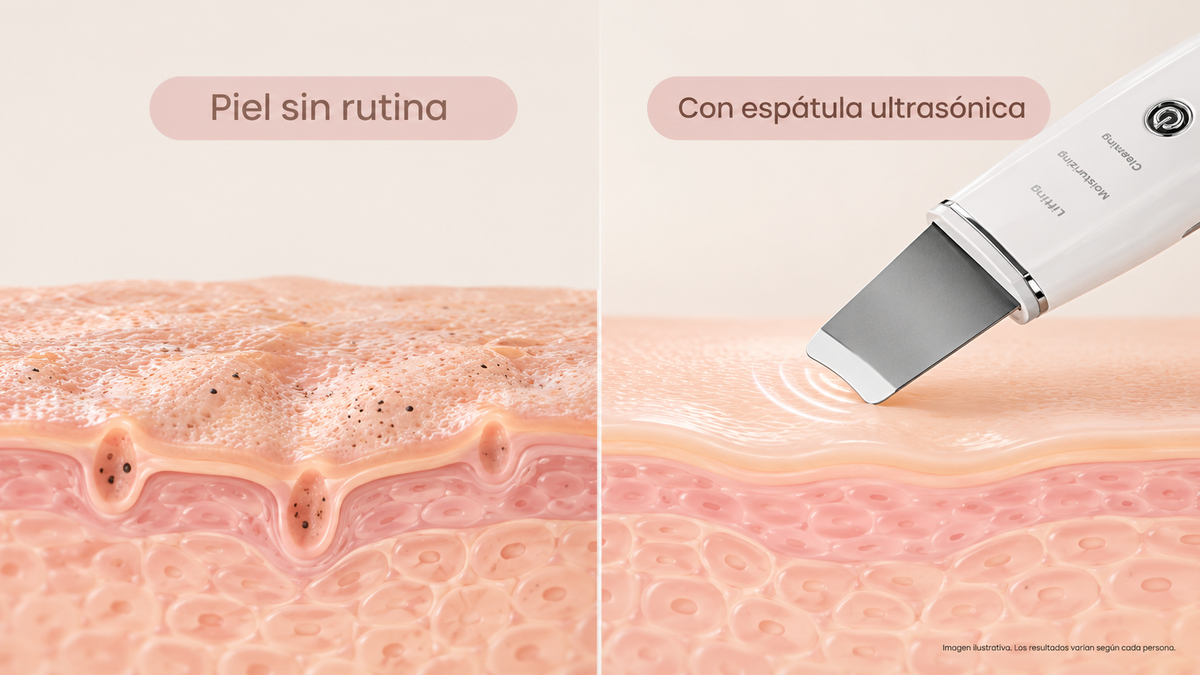Kervana® Espátula Facial