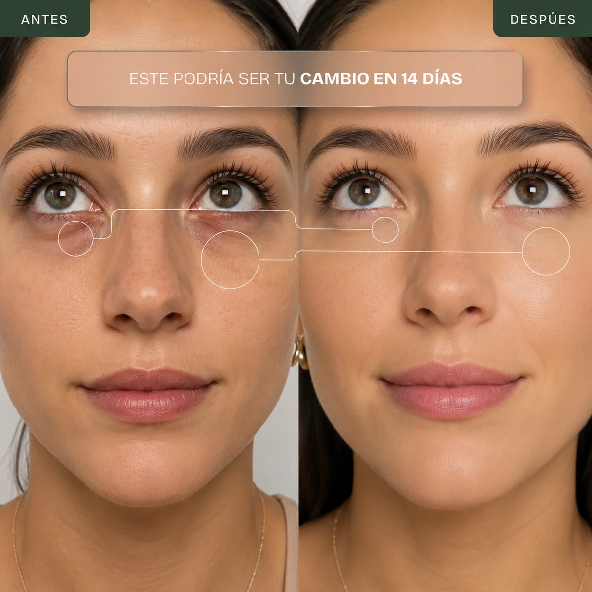 Kervana® Masajeador de Ojos con Luz Roja